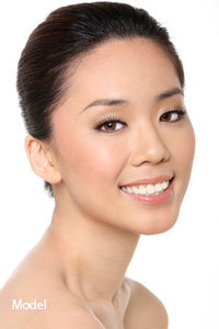 Fat Transfer and Injections in San Ramon, CA