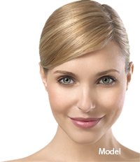 Facelift in San Ramon, CA