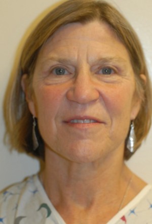 Before-Liquid Facelift