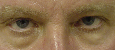 Cosmetic Procedures for Men in San Ramon, CA