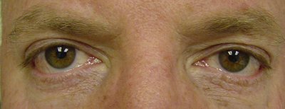 Cosmetic Procedures for Men in San Ramon, CA