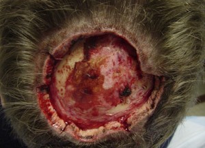 Before-Scalp Reconstruction