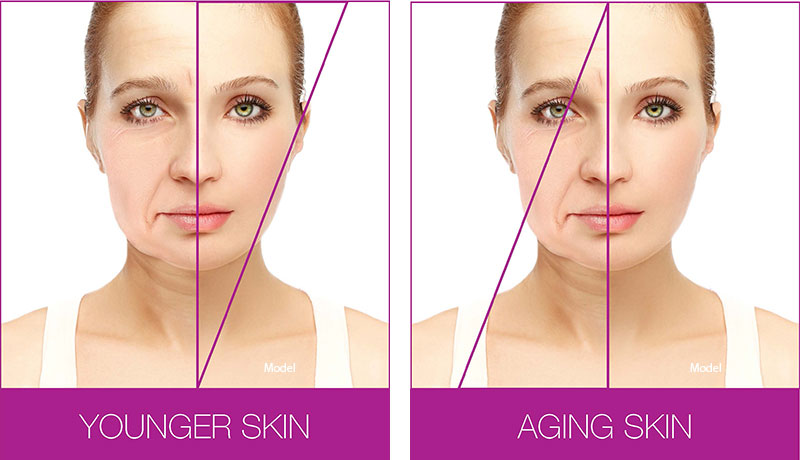 Profound® Skin Tightening in San Ramon, CA