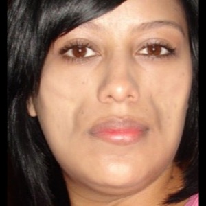 Before-Filler For Lupus