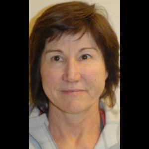 After-Liquid Facelift